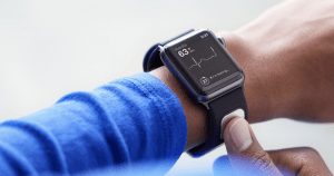 The FDA just cleared an Apple Watch band that measures your heart's electrical activity 34