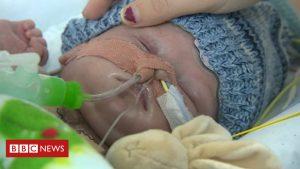 New heart baby dies after transplant 69