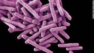 Possible release of tuberculosis bacteria investigated in Baltimore 41