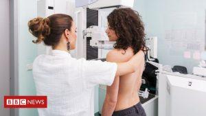 Breast cancer risk test 'game changer' 26