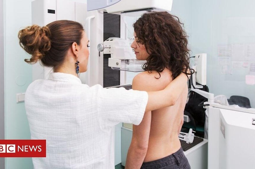 Breast cancer risk test ‘game changer’