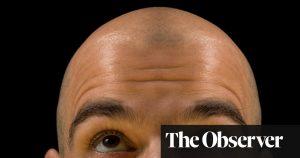 The new growth in hair loss research 1