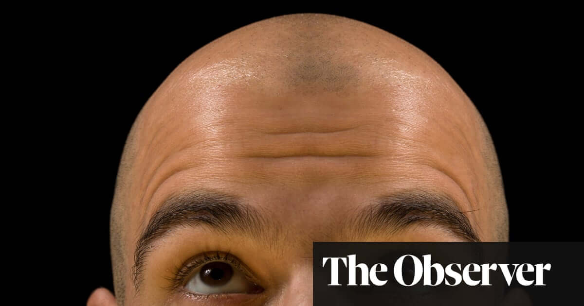 new research about hair loss